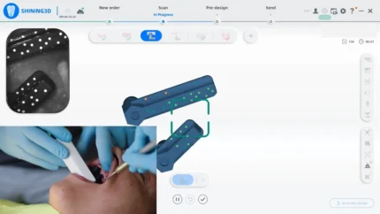 اسکنر داخل دهانی Aoralscan Elite
