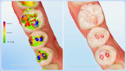 Aoralscan Elf Intraoral Scanner